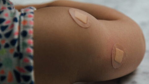 Arm of young child with band aids from vaccine